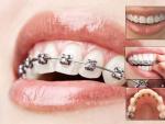 Dr. Mukesh's Dental and Implant Care Center